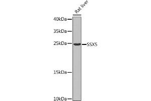Western blot analysis of extracts of Rat liver, using SSX5 Rabbit pAb  at 1:1000 dilution. (SSX5 Antikörper  (AA 1-229))