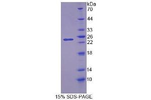 SDS-PAGE (SDS) image for 5',3'-Nucleotidase, Mitochondrial (NT5M) (AA 30-193) protein (His tag) (ABIN6239458)