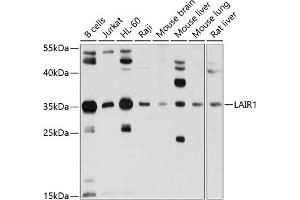 Western blot analysis of extracts of various cell lines, using L antibody (ABIN6131546, ABIN6143063, ABIN6143064 and ABIN6214255) at 1:1000 dilution. (LAIR1 Antikörper)