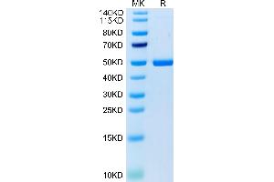Cynomolgus 4-1BB Ligand on Tris-Bis PAGE under reduced condition. (TNFSF9 Protein (AA 68-251) (Fc Tag))