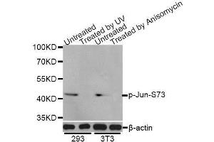 Western blot analysis of extracts of 293 and NIH/3T3 cells, using Phospho-Jun-S73 antibody (ABIN5969904) at 1/1000 dilution. (C-JUN Antikörper  (pSer73, Ser73))