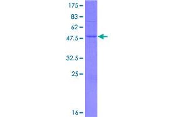 WARS2 Protein (AA 1-220) (GST tag)