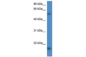 Human HepG2; WB Suggested Anti-GPT2 Antibody Titration: 0. (GPT2 Antikörper  (C-Term))
