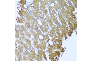 Immunohistochemistry of paraffin-embedded human liver injury using STRN antibody at dilution of 1:100 (x40 lens). (Striatin Antikörper)