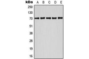 Western blot analysis of ATF2 (pS498) expression in HeLa UV-treated (A), Jurkat (B), NIH3T3 (C), SP2/0 UV-treated (D), MCF7 UV-treated (E) whole cell lysates. (ATF2 Antikörper  (C-Term, pSer498))