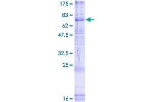 Image no. 1 for RFT1 Homolog (RFT1) (AA 1-541) protein (GST tag) (ABIN1317869) (RFT1 Protein (AA 1-541) (GST tag))