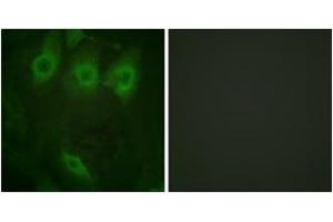 Immunofluorescence analysis of HeLa cells, using EGFR (Phospho-Tyr1016) Antibody. (EGFR Antikörper  (pTyr1016))