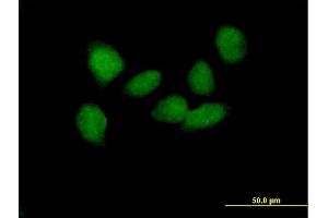 Immunofluorescence of purified MaxPab antibody to SOX6 on HeLa cell. (SOX6 Antikörper  (AA 1-828))