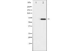 Western blot analysis of ZAP-70 expression in Jurkat whole cell lysates,The lane on the left is treated with the antigen-specific peptide.