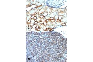 Immunohistochemical staining (Formalin-fixed paraffin-embedded sections) of (A) human tonsil and (B) human pancreas with Mitochondria monoclonal antibody, clone AE-1 . (Mitochondria Antikörper)