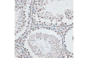 Immunohistochemistry of paraffin-embedded mouse testis using AQR antibody (ABIN6133411, ABIN6137057, ABIN6137058 and ABIN6221662) at dilution of 1:100 (40x lens). (AQR Antikörper  (AA 400-700))