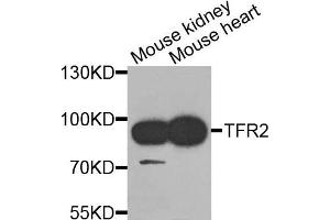 Western blot analysis of extracts of mouse kidney and mouse heart cells, using TFR2 antibody. (Transferrin Receptor 2 Antikörper)