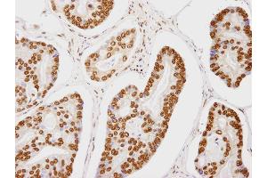 anti-Transcription Elongation Regulator 1 (TCERG1) (AA 1-50) antibody