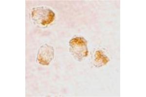 Immunocytochemistry staining of HL-60 cells using BAX polyclonal antibody  at 2 ug/mL . (BAX Antikörper  (N-Term))
