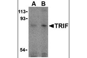 Western Blotting (WB) image for anti-Toll-Like Receptor Adaptor Molecule 1 (TICAM1) (C-Term) antibody (ABIN1030771) (TICAM1 Antikörper  (C-Term))