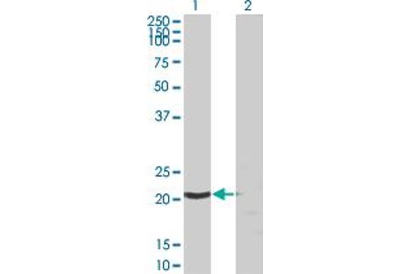 SSSCA1 Antikörper  (AA 1-199)