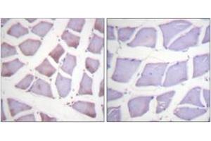 Immunohistochemistry analysis of paraffin-embedded human skeletal muscle tissue, using XIAP (Ab-87) Antibody. (Intestinal Alkaline Phosphatase Antikörper  (AA 53-102))