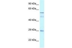 Image no. 1 for anti-GDNF Family Receptor alpha 4 (GFRA4) (AA 182-231) antibody (ABIN6747540)