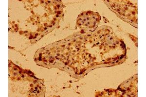 Immunohistochemistry of paraffin-embedded human testis tissue using ABIN7166328 at dilution of 1:100 (WWC2 Antikörper  (AA 828-1127))