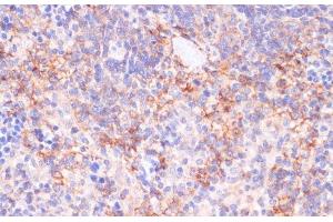 Immunohistochemistry of paraffin-embedded Rat spleen using NT5E / CD73 Polyclonal Antibody at dilution of 1:200 (40x lens). (CD73 Antikörper)