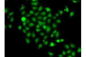 Immunofluorescence analysis of A-549 cells using COPS2 antibody (ABIN6130123, ABIN6138877, ABIN6138878 and ABIN6222819). (COPS2 Antikörper  (AA 1-310))