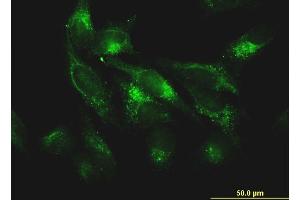 Immunofluorescence of monoclonal antibody to FTL on HeLa cell. (FTL Antikörper)