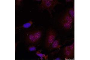 Image no. 2 for anti-Jun B Proto-Oncogene (JUNB) (pSer79) antibody (ABIN196657) (JunB Antikörper  (pSer79))