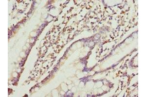 Immunohistochemistry of paraffin-embedded human small intestine tissue using ABIN7167209 at dilution of 1:100