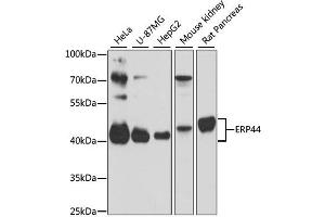Western blot analysis of extracts of various cell lines, using ERP44 antibody (ABIN6291618) at 1:3000 dilution. (ERP44 Antikörper)