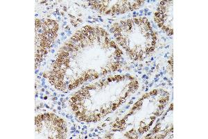 Immunohistochemistry of paraffin-embedded human colon using KIF22 antibody  at dilution of 1:100 (40x lens). (KIF22 Antikörper  (AA 456-665))