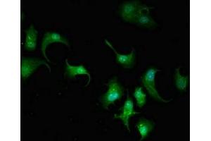 Immunofluorescent analysis of MCF-7 cells using ABIN7143098 at dilution of 1:100 and Alexa Fluor 488-congugated AffiniPure Goat Anti-Rabbit IgG(H+L) (ARPC5L Antikörper  (AA 15-124))