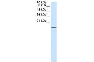 WB Suggested Anti-HDAC6 Antibody Titration:  0.