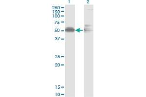 Western Blot analysis of AHSG expression in transfected 293T cell line by AHSG monoclonal antibody (M02), clone 1D8. (Fetuin A Antikörper  (AA 19-367))