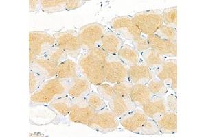 Immunohistochemistry of paraffin embedded mouse skeletal muscle using Junctophilin2 (ABIN7074393) at dilution of 1: 600 (400x lens) (Junctophilin 2 Antikörper)
