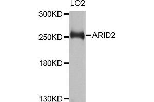 Western blot analysis of extracts of LO2 cells, using ARID2 antibody. (ARID2 Antikörper)