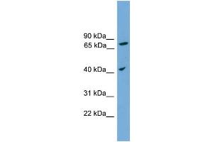 WB Suggested Anti-UNQ1887 Antibody Titration: 0. (UNQ1887 (Middle Region) Antikörper)
