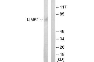 Western blot analysis of extracts from mouse brain cells, using LIMK1 antibody. (LIM Domain Kinase 1 Antikörper  (Internal Region))