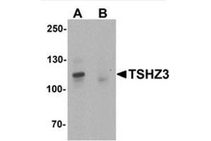 Western blot analysis of TSHZ3 in mouse brain tissue lysate with TSHZ3 / ZNF537 Antibody at 1 µg/ml in (A) the absence and (B) the presence of blocking peptide. (TSHZ3 Antikörper  (N-Term))