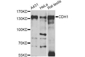 Western blot analysis of extracts of various cell lines, using CDH1 antibody (ABIN5997408) at 1/1000 dilution. (E-cadherin Antikörper)