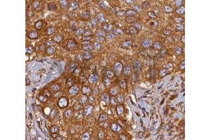ABIN6268689 at 1/100 staining human breast tissues sections by IHC-P.