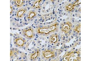 Immunohistochemistry of paraffin-embedded Mouse kidney using ADRBK1 Polyclonal Antibody at dilution of 1:200 (40x lens). (GRK2 Antikörper)