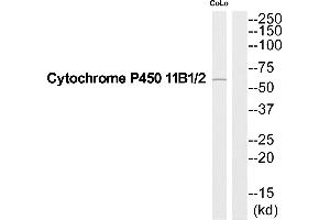 Western blot analysis of extracts from COLO205 cells, using Cytochrome P450 11B1/2 antibody. (Cytochrome P450 11B1/2 (C-Term) Antikörper)