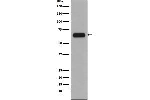 Western blot analysis of TCF3 expression in A431 cell lysate.