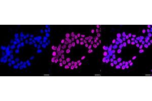 anti-SET Nuclear Oncogene (SET) antibody