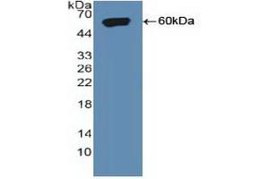 Figure. (Sortilin 1 Antikörper  (AA 50-320))