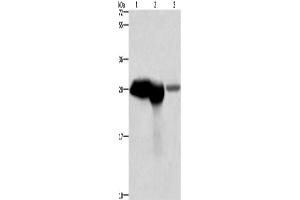 Western Blotting (WB) image for anti-Calbindin (CALB1) antibody (ABIN2423032) (CALB1 Antikörper)