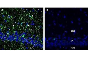 Expression of CX3CR1 in rat hippocampus - Immunohistochemical staining of perfusion-fixed frozen rat brain sections with Anti-CX3CR1 (extracellular) Antibody (ABIN7043047, ABIN7044194 and ABIN7044195), (1:300), followed by goat anti-rabbit-AlexaFluor-488. (CX3CR1 Antikörper  (Extracellular))