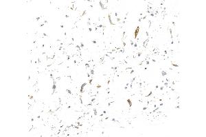 Immunocytochemistry (ICC) image for anti-Selectin P (Granule Membrane Protein 140kDa, Antigen CD62) (SELP) (AA 42-709) antibody (ABIN7795666)