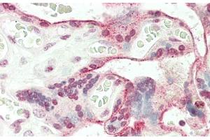Immunohistochemistry (Paraffin-embedded Sections) (IHC (p)) image for anti-Jumonji C Domain-Containing Histone Demethylase 1 Homolog D (JHDM1D) (AA 290-316) antibody (ABIN651309)