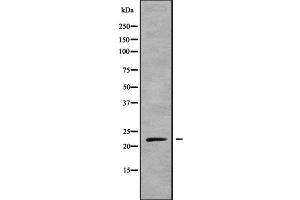 Western blot analysis NKIRAS1 using mouse liver lysates (NKIRAS1 Antikörper  (C-Term))